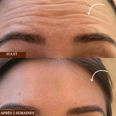 Aurevia lift & glow