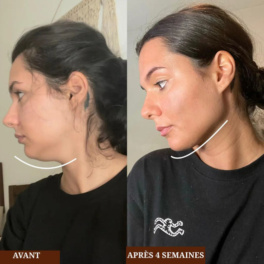 Aurevia lift & glow