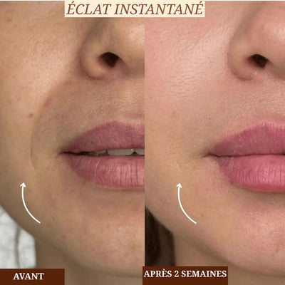 Aurevia lift & glow